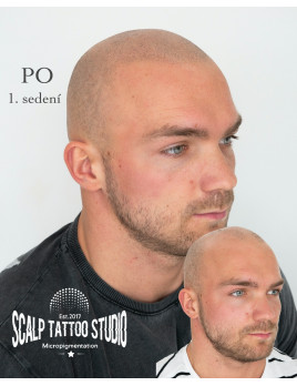 Scalp Tattoo Studio