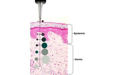 JAK ZABRÁNIT VYBLEDNUTÍ ČERSTVÉHO TETOVÁNÍ